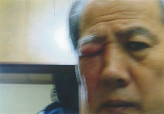 怪我から３日目