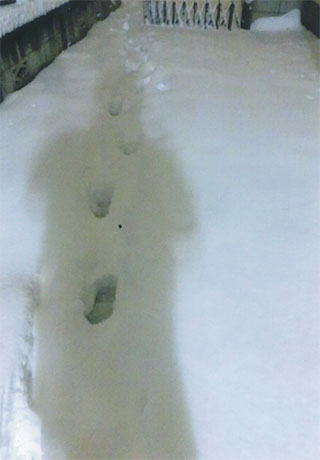 歩くのも大変です